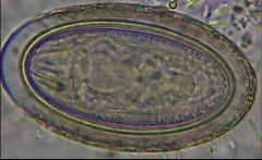 What is your best guess as to the type of parasite that produced this egg? What makes you think that?