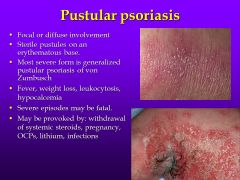 For really gnarly psorisasis... (which can happen when you give steroids and then stop suddenly...) What is the best treatment for this condition?