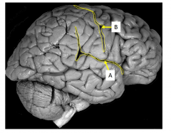 Divides Temporal lobe inferiorly from parietal and frontal lobe. A. 