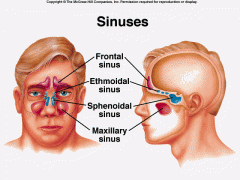paranasal sinuses


 