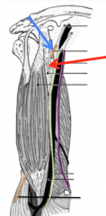 Proximal: Coracoid process of the scapula
Distal: Mid humerus