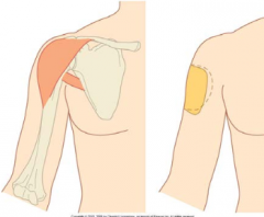 1. C8 - T1
2. Innervates muscles of the shoulder abductors and also the deltiod
3. Innervates skin of the shoulder (military badge region)
4. Can be injured through shoulder dislocation