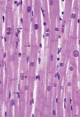 Size, shape, and organization relative to each other.

Cardiac muscle has intercalated discs and the fibers have variable length. Larger T tubules. Cell nuclei are located in the center of the fiber usually. 

large mitochondria are densely pa...