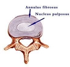 1. Nucleus pulposus (centre) 

2. Anulus fibrosis (covering)