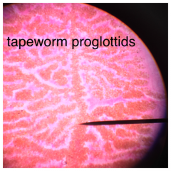 Tapeworm proglottids