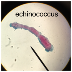 Echinococcus