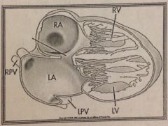 What is this heart schematic demonstrating?