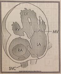What is this heart schematic demonstrating?