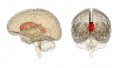 The corpus callosum connects which portions of the brain?