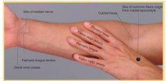 A superficial muscle of the forearm which inserts on the CFT and attaches at the second and third metacarpals. This laterally deviates the forearm and flexes the wrist.