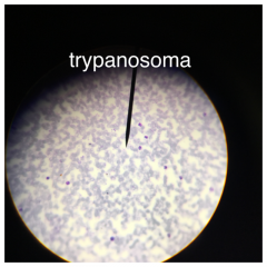  - Viewed at: 40x objective

- Stained with: a purple dye

- Genus name: Trypanosoma 

- Move: means of flagella

Get a Trypanosoma infection: by a kissing bug