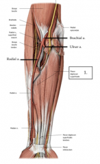 This intermediate anterior forearm muscle. It originates from the medial epicondyle and the oblique line of the radius to the base of the middle phalanges of digits 2-5 (forms four tendons). It flexes the wrist and the digits proximal interphalang...