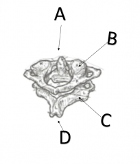 What structure is A on cervical vertebra C2?