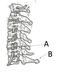 What is the name of structure B on cervical vertebrae? 