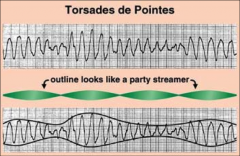 *“Twisting of Spikes” aka polymorphic VT.
*Extremely dangerous rhythm that may quickly degenerate to ventricular fibrillation (VF).
*Can occcur with many other antiarrhythmics.