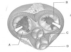 This cross section of the heart shows the ventricles in a state of ....