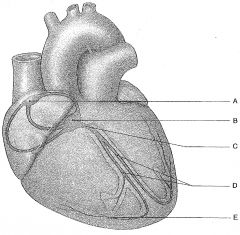 The electrical part of the heart indicated by letter D is the....
