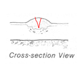 Draw where the knife would cut for a biopsy in the cross-section view