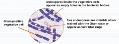 Endospores. However, the vegetative cell is, thus showing the presence of endospore.