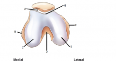 What view of the Patella is this and what are its parts?