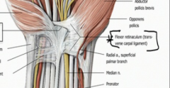 It is the transverse carpal ligament that is on the anterior side of the wrist. This goes medially from the pisiform and the hook of the hamate and attaches on the scaphoid tubercle and the ridge of the tapezium. This is a continuation of the ante...
