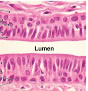 many layers column shaped


fucntion proteciton found in small layers of pharyny epiglottis, anus, mammary glands, slavary gland ducts and urethira