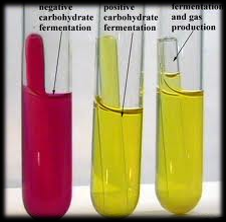 which biochemical test is this? Which tube is positive? Which tube is negative?