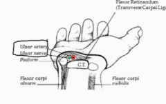 The canal through which the ulnar nerve and the ulnar artery pass just lateral to the pisiform.