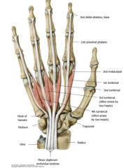 The Tendons of the FDP along the metacarpals then anteriorly to the MCP joints to blend in with the extension expansion hoods of the digits.