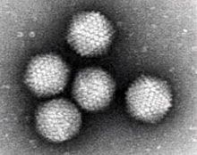 What family of viruses is shown in this EM image?
