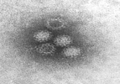 Caliciviruses are all +ssRNA viruses that are nonenveloped and the virion is icosohedral in shape.