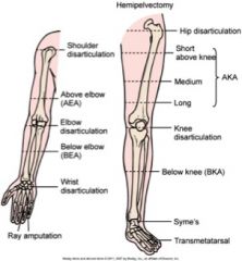 Locations include: upper and lower extremities. Descriptions of amputations are illustrated above.