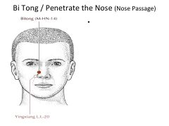 4*- Unlocks sinuses (VERY POWERFUL). Location: Upper Curl of nose. (Needling done at LI-20 towards Bi Tong)
