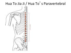 3*- Location: 0.5cun lateral to spinous process. Alt. to Shu points. Safer than UB points above the diaphragm. 


o	Neck Jai Ji points treat neck pain, stiff neck, cervical spondylosis. 
o	T-1 to T-4 Treat Lung and upper limb disorders.  Cough...