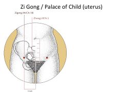 3*- Location: 3 Cun lateral to Ren 3. Regulates Semen Palace. Tx: Infertility. Happy Baby Points- Kd-16, Ren-3,6, St-29 and Zi Gong.