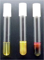   Which of these tubes contains organisms that are capable of producing hydrogen sulfide?  