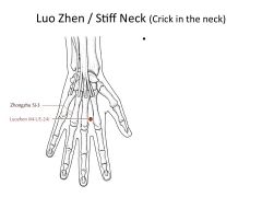 3*- “Crick in the Neck”- Tx: Stiff Neck, neck pain.