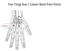 3*- “Xue= Sway” Location: Two points on the dorsum of the hand. Tx: Acute lower back pain/strain, very sensitive (THE BEST).