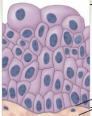 It is unusual stratified epithelium (especially for repeated cycles of stretching, like the bladder)