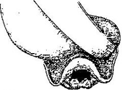 The following is a view obtained at direct larngoscopy.
 
According to the classification of Cormack-Lehane, this view would be classed as grade
A.	1
B.	2
C.	3
D.	4
E.	5