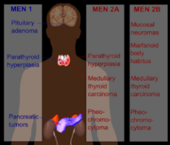 the difference between men1 , men 2(sipple syndrome ) , and men 3 is.....