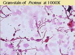 what is the tx for proteus mirabilis?


 


(gram stain img--> gram neg)