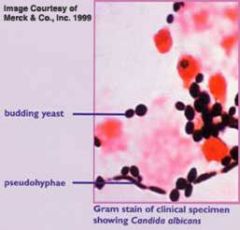 candida sp.


*confirm w/ crystal violet stain


 


Tx: nystatin or clotrimazole