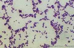 Staphylococcus saprophyticus


 


(cause 5-15% UTIs)