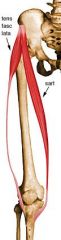 Origin: ASIS

Insertion: Iliotibial band

Action: Helps stabilize and steady the hip and knee joints by putting tension on the iliotibial band of fascia

Innervation: Superior gluteal - Common to abductors

Spinal Segment: L4-S1 (P) - Comm...