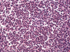 Which type of leukocytes are depicted?
How can you tell?