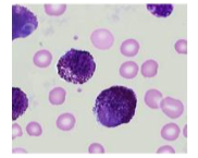 What leukocyte is depicted. How can you tell?