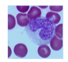 What leukocyte is depicted here? How can you tell?