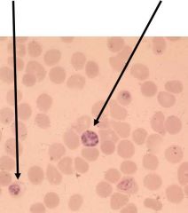 schuffner's dots- small purplish red granules found in RBCs (plasmodium vivax)


 


wright (img) & giemsa stain