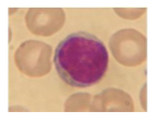 Which type of leukocyte is depicted here? Which form is predominant in the circulation?